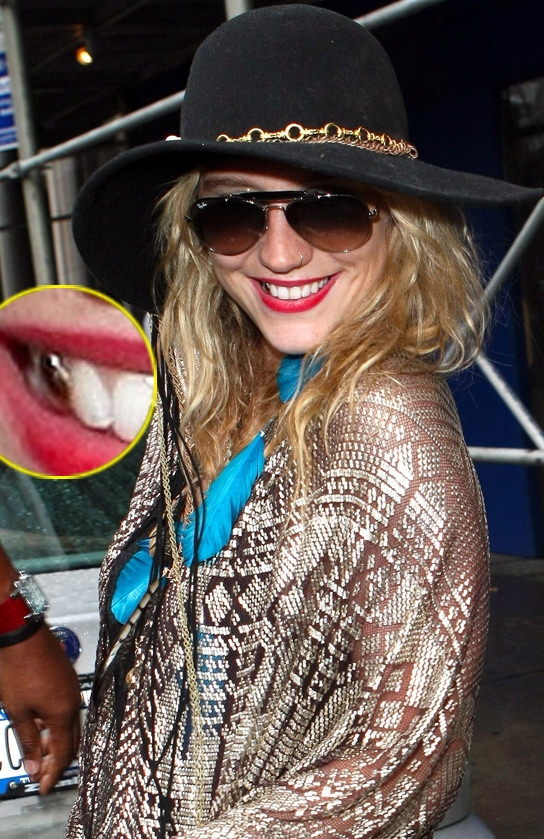 Ke$ha shows off her Ray Ban sunglasses and gold tooth.
